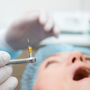 Closeup of dental implant held by dentist before being surgically placed