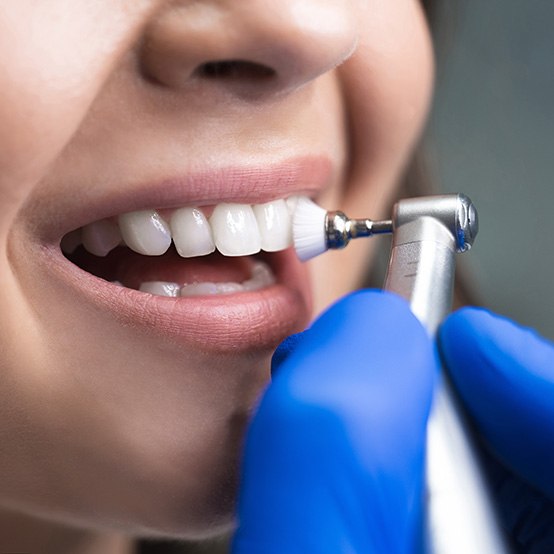 Up-close view of patient’s teeth being polished