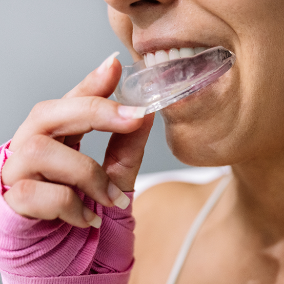 Woman placing a clear mouthguard over her teeth