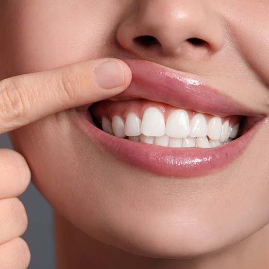 Close up of person pointing to their gums