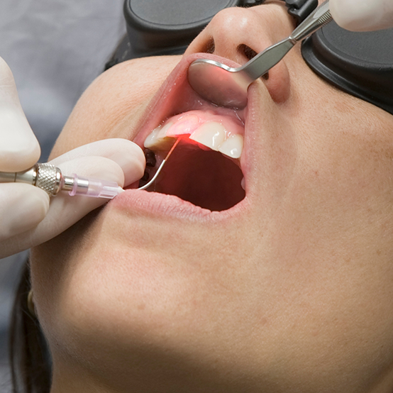 Dental patient receiving treatment with laser